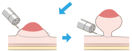 EMR