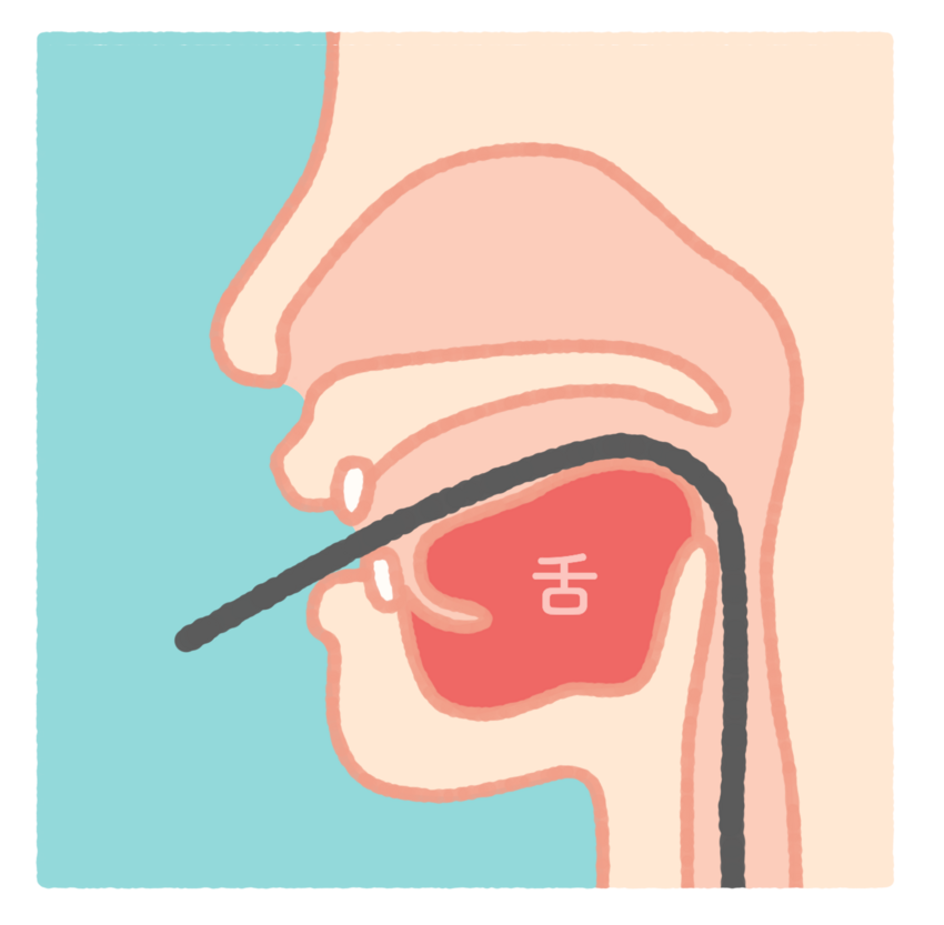 スコープ