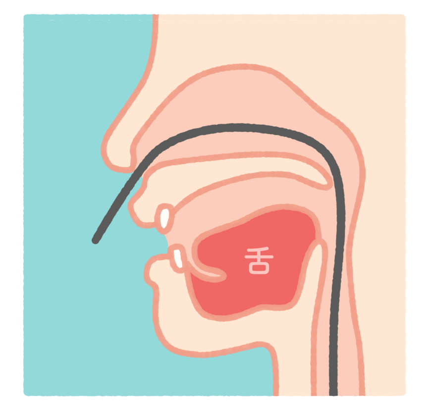 スコープ